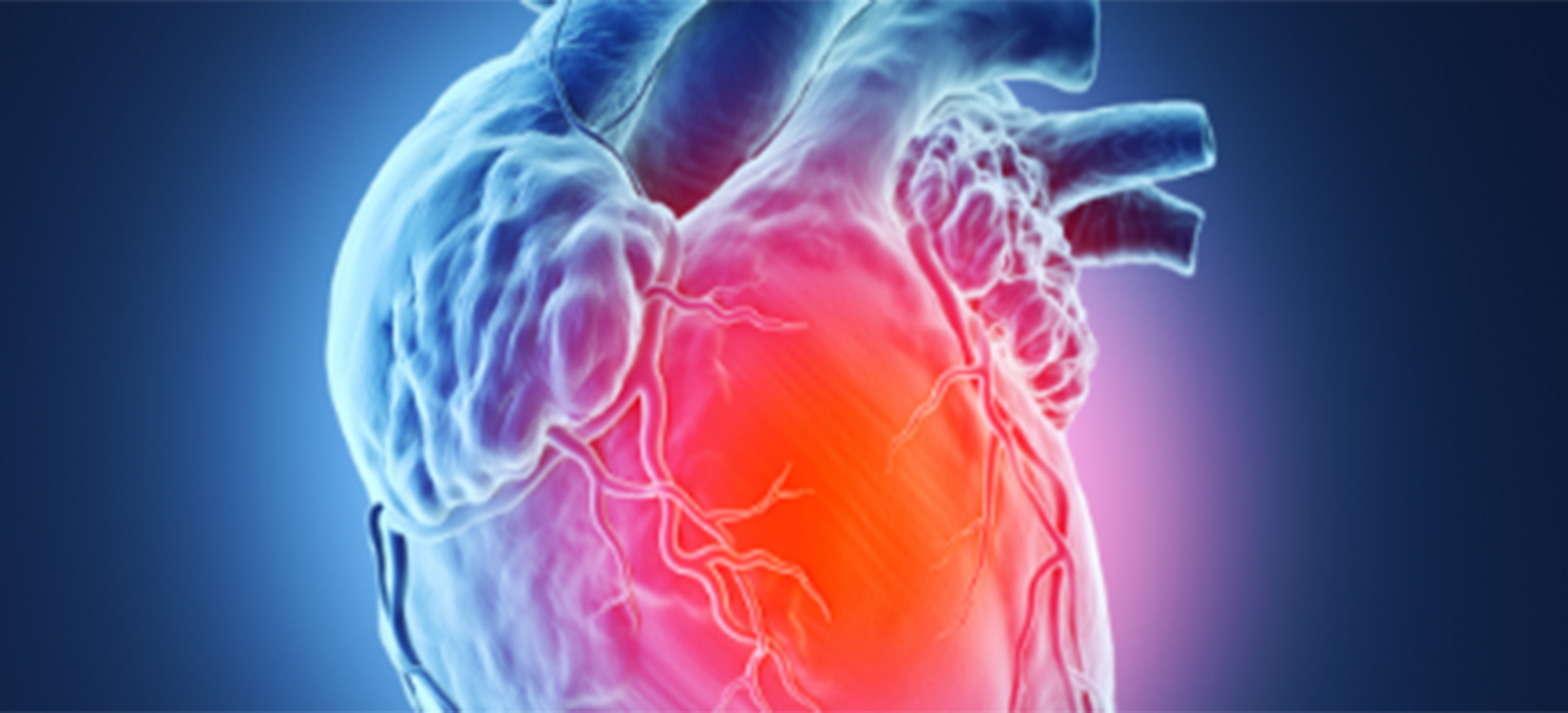 Cardiovascular disease event series